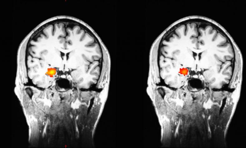 meditation and science